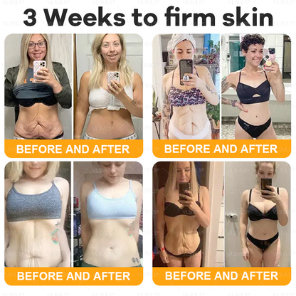 VLSVLS® Bee Venom Comprehensive Cream ✈️LAST DAY 80% OFF (Sagging Skin, Fine Lines, Loss of Firmness, Flat Bust, Drooping Hips, and More)