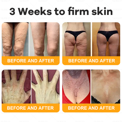 VLSVLS® Bee Venom Comprehensive Cream ✈️LAST DAY 80% OFF (Sagging Skin, Fine Lines, Loss of Firmness, Flat Bust, Drooping Hips, and More)