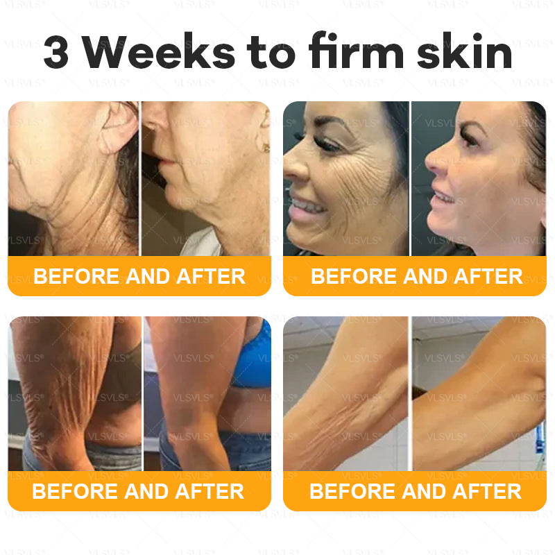 VLSVLS® Bee Venom Comprehensive Cream ✈️LAST DAY 80% OFF (Sagging Skin, Fine Lines, Loss of Firmness, Flat Bust, Drooping Hips, and More)
